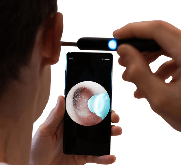WaxOut – Earwax Removal Camera Tool